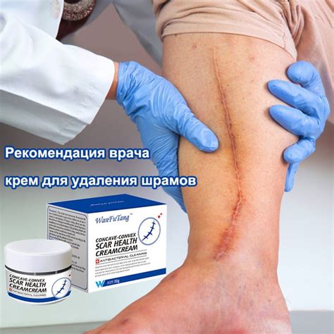Крем для удаления шрамов/Гель для удаления шрамов 30г Крем от растяжек ...