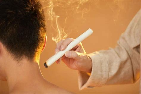 Moxibustion: Principles, Benefits, Side Effects, and Precautions ...