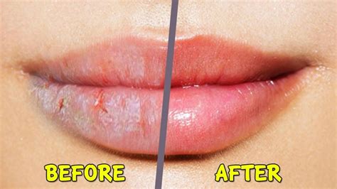 Olive Oil Good For Dry Lips at Catherine Saba blog