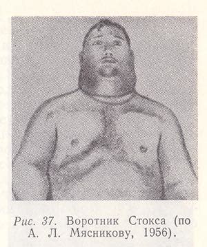 Осмотр сосудов | Пропедевтика внутренних болезней