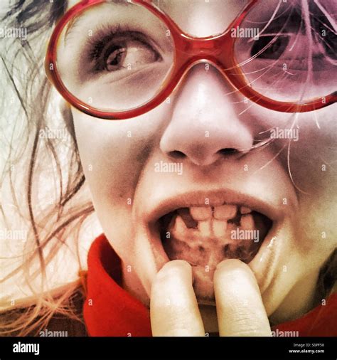 Little girl showing missing teeth Stock Photo - Alamy