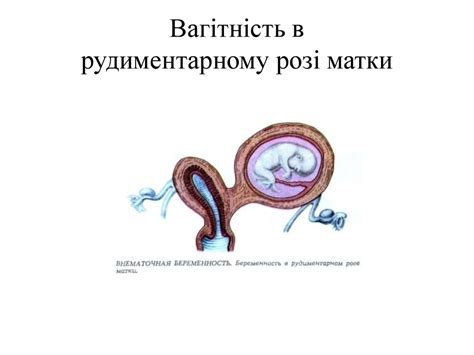 Кровотечі в І половині вагітності - презентация онлайн