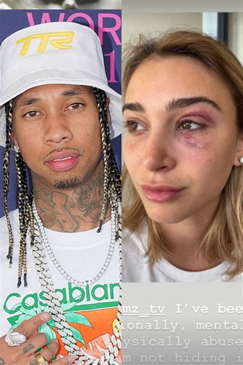 Tyga's Girlfriend Camaryn Swanson Accused Him Of Domestic Violence