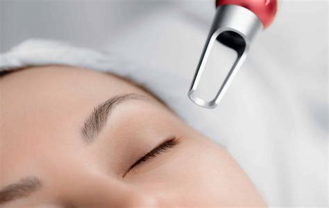 5 Unexpected Benefits of Levisa Lazer You Won't Believe! - na9jy32