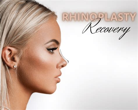 Rhinoplasty Recovery Timeline - The More Clinics