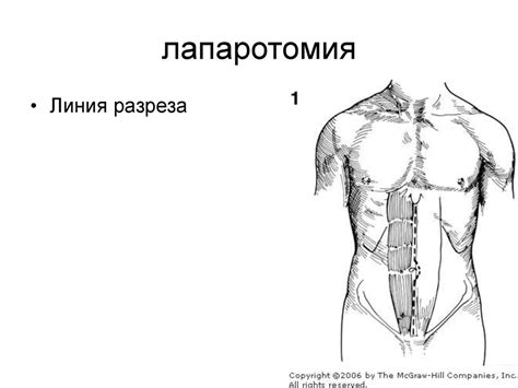 Операции на желудке - презентация онлайн