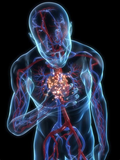 Doctor Fails to Properly Diagnose a Heart Attack