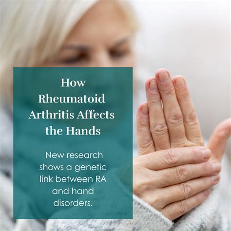 Columbia Arthritis Center | Columbia SC