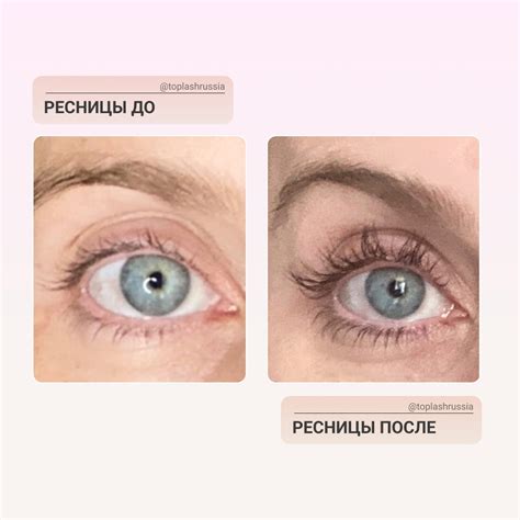 Сыворотка для роста ресниц Toplash® | ВКонтакте