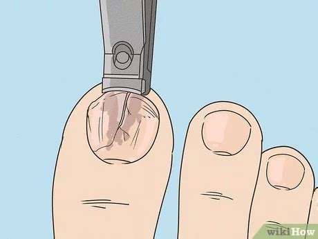 how to fix a broken toenail on a dog