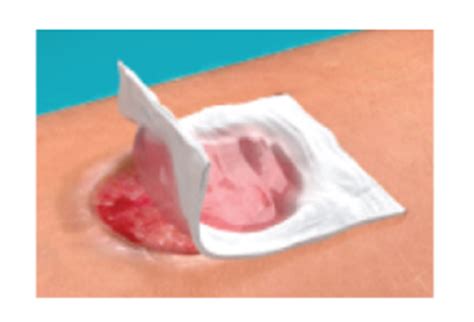 module  wound bed preparation flashcards quizlet