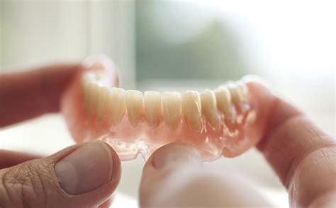 One Tooth Denture – Material Options | Costs from £250 | Mint Dental SE1