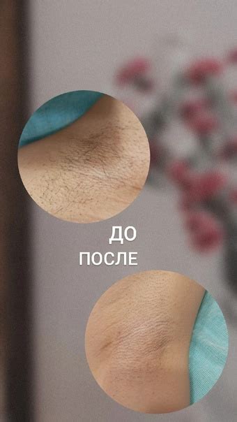 Ищу моделей на шугаринг Подмышечные впадины-200р Остальные зоны-350р ...
