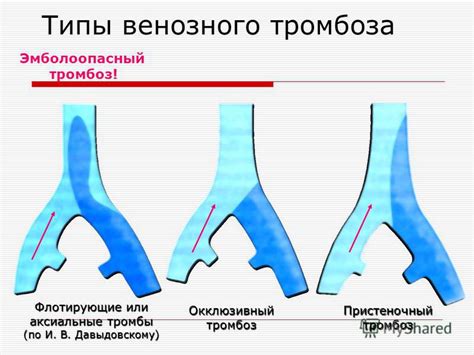 Презентация на тему: "Профилактика венозных тромбоэмболических ...
