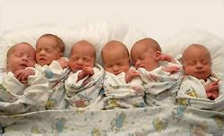 difference  single birth  multiple births single birth