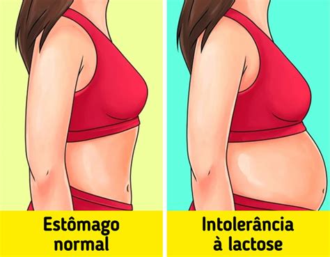 Intolerância A Lactose Incha A Barriga