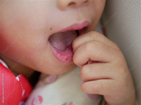 How To Help Baby With Dry Lips | Lipstutorial.org