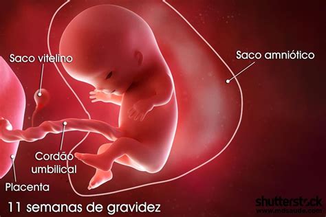 Bebê Com 11 Semanas