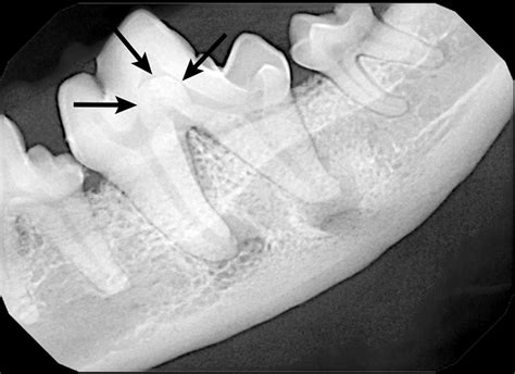 Interpreting Dental Radiographs | Clinician's Brief