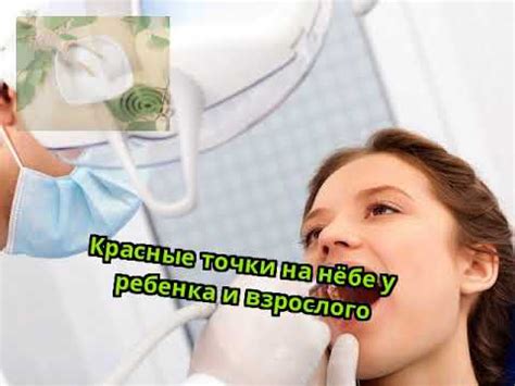Красные точки на нёбе у ребенка и взрослого - YouTube