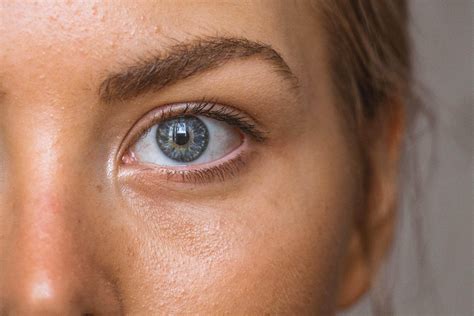 causes of eye bags 6