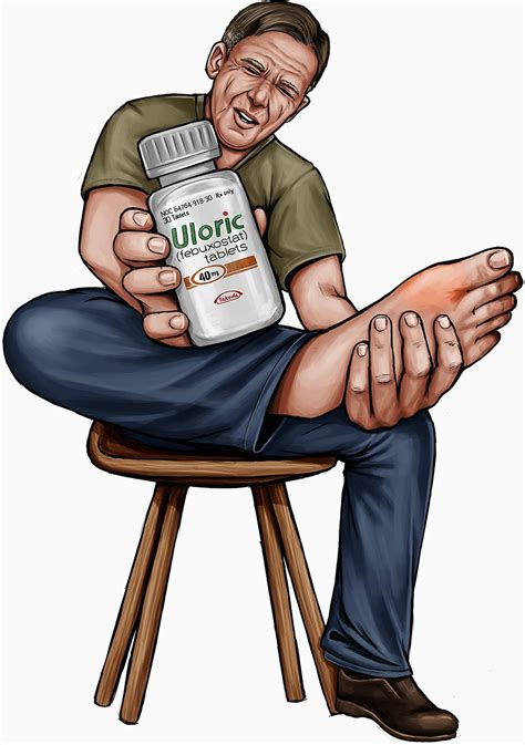 Uloric Lawsuit | Heart Attack & Stroke