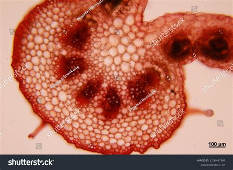 193 Collenchyma Sclerenchyma Parenchyma Cells Images, Stock Photos ...