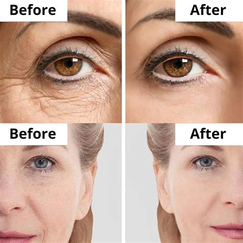 Anti-Aging Cream with Argireline & Stem Cells | DermaSet