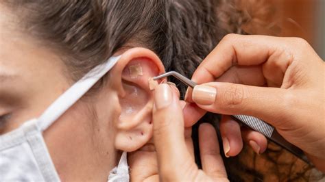 Ear Piercings That Provide Acupuncture Benefits