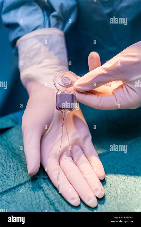 Cochlear Implant High Resolution Stock Photography and Images - Alamy