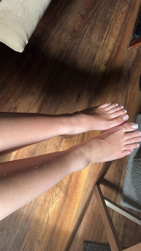 Twisted ankle : r/DiagnoseMe