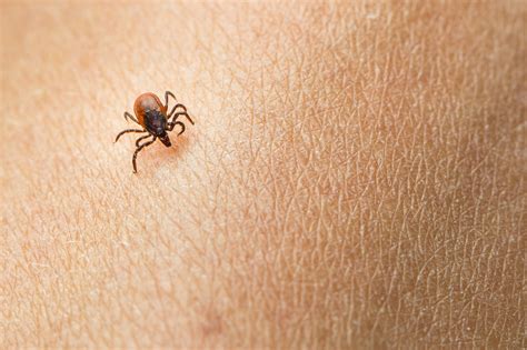 Illnesses You Can Contract From Ticks (Other Than Lyme Disease)