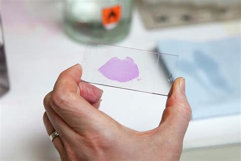 dyed tissue specimen  photograph  science photo library pixels