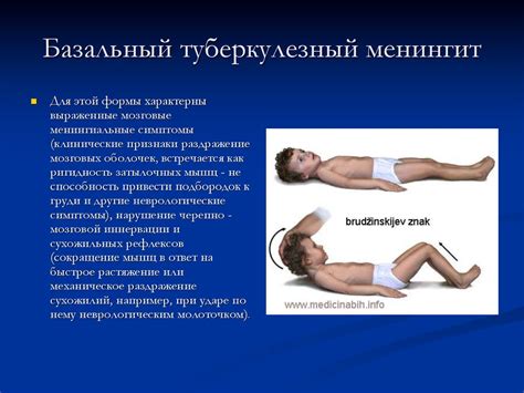 Туберкулезный менингит - презентация онлайн