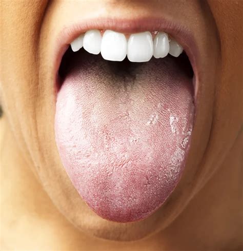 Healthy tongue Stock Photos, Royalty Free Healthy tongue Images ...