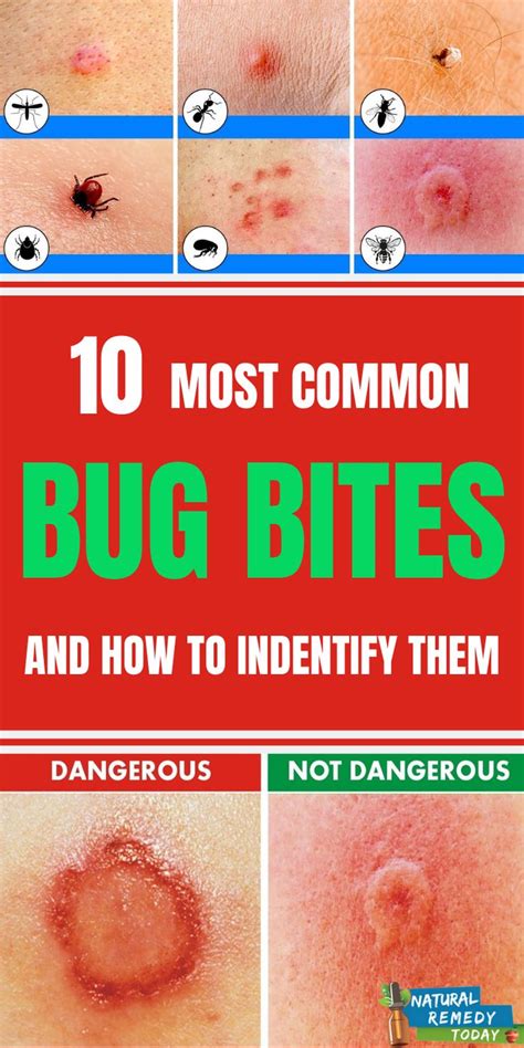 common bug bites    identify  bug