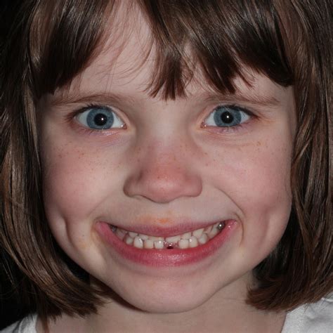 The McLaughlin Family Blog: Look Who Just Lost Her First Baby Tooth