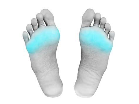 What Causes Pain On Bottom Of Ball Of Foot at Evie Rounsevell blog
