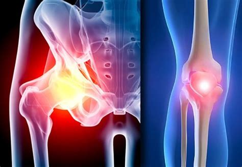 Orthopedic surgery | TOTAL HIP AND KNEE REPLACEMENT - CubaHeal