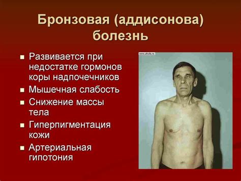 Эндокринная система - презентация онлайн