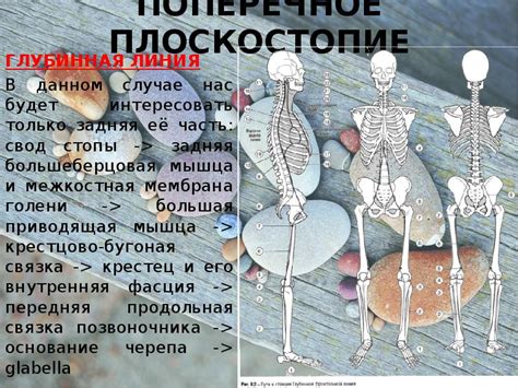 Плоскостопие