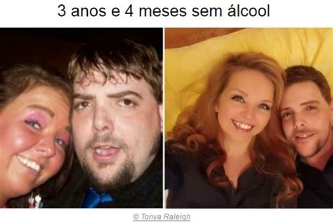 Antes E Depois Do Álcool - Uso De Alcool Antes E Depois