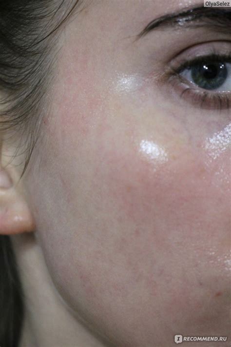Пилинг для лица Mediderma желтый Retises CT Yellow Peel - «Один из ...