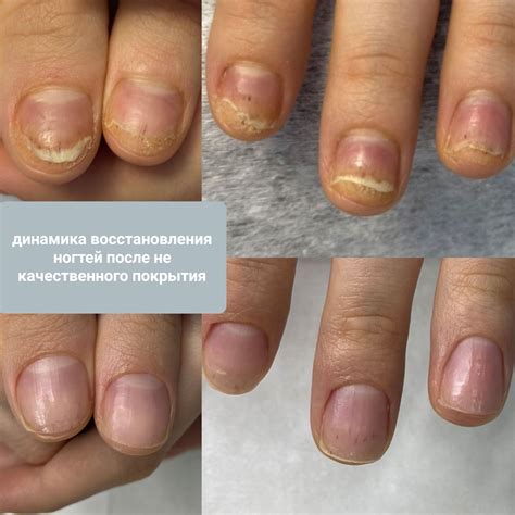 Ляйсян Костина — Отзывы, Цены - подолог в Тольятти | Телефон и онлайн ...