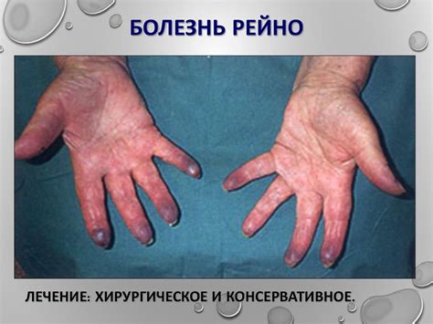 Заболевания периферических артерий. Артериальная недостаточность ...