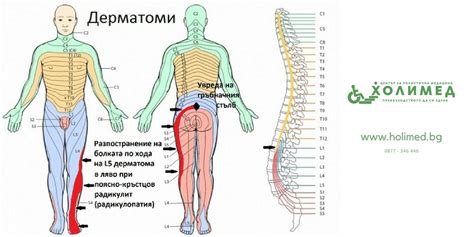 ᐉ ⚕️ Радикулит – причини, симптоми, диагностика и лечение — Холимед