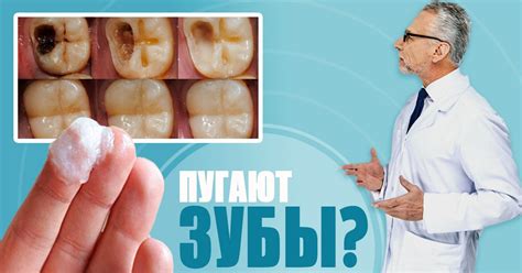 Домашнее отбеливание зубов