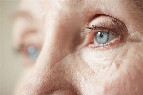 Macular Degeneration | Age-related Macular Degeneration | MedlinePlus