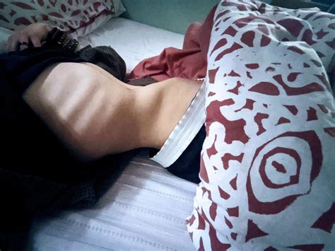 Myself. : r/HipBones