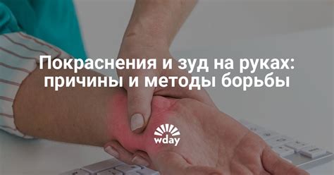 Покраснения на руке, покраснение кожи чешется — www.wday.ru | WDAY